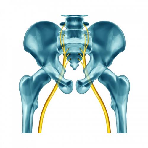 In Focus: Cauda Equina Syndrome- A Spinal Emergency